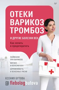 Обложка книги Отеки, варикоз, тромбоз и другие болезни вен. Как лечить и предотвратить